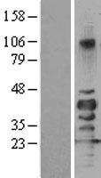 SIRT7 / Sirtuin 7 Protein - Western validation with an anti-DDK antibody * L: Control HEK293 lysate R: Over-expression lysate