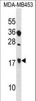 SIT1 Antibody - SIT1 Antibody western blot of MDA-MB453 cell line lysates (35 ug/lane). The SIT1 antibody detected the SIT1 protein (arrow).