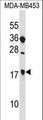 SIT1 Antibody - SIT1 Antibody western blot of MDA-MB453 cell line lysates (35 ug/lane). The SIT1 antibody detected the SIT1 protein (arrow).