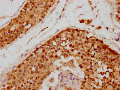 SIVA1 / SIVA Antibody - IHC image of SIVA1 Antibody diluted at 1:700 and staining in paraffin-embedded human testis tissue performed on a Leica BondTM system. After dewaxing and hydration, antigen retrieval was mediated by high pressure in a citrate buffer (pH 6.0). Section was blocked with 10% normal goat serum 30min at RT. Then primary antibody (1% BSA) was incubated at 4°C overnight. The primary is detected by a biotinylated secondary antibody and visualized using an HRP conjugated SP system.