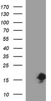 SIVA1 / SIVA Antibody - HEK293T cells were transfected with the pCMV6-ENTRY control (Left lane) or pCMV6-ENTRY SIVA1 (Right lane) cDNA for 48 hrs and lysed. Equivalent amounts of cell lysates (5 ug per lane) were separated by SDS-PAGE and immunoblotted with anti-SIVA1.