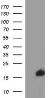 SIVA1 / SIVA Antibody - HEK293T cells were transfected with the pCMV6-ENTRY control (Left lane) or pCMV6-ENTRY SIVA1 (Right lane) cDNA for 48 hrs and lysed. Equivalent amounts of cell lysates (5 ug per lane) were separated by SDS-PAGE and immunoblotted with anti-SIVA1.