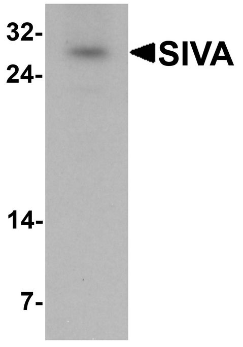 SIVA1 / SIVA Antibody - Western blot analysis of SIVA in mouse liver tissue lysate with SIVA antibody at 1 ug/ml.