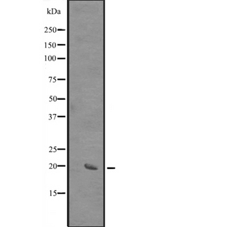 SIVA1 / SIVA Antibody - Western blot analysis of SIVA expression in HEK293 cells. The lane on the left is treated with the antigen-specific peptide.