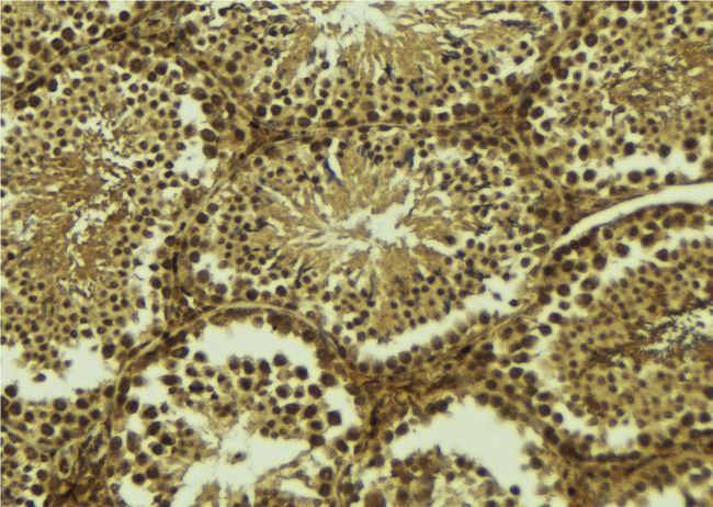 SIVA1 / SIVA Antibody - 1:100 staining mouse testis tissue by IHC-P. The sample was formaldehyde fixed and a heat mediated antigen retrieval step in citrate buffer was performed. The sample was then blocked and incubated with the antibody for 1.5 hours at 22°C. An HRP conjugated goat anti-rabbit antibody was used as the secondary.