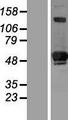 SIVA1 / SIVA Protein - Western validation with an anti-DDK antibody * L: Control HEK293 lysate R: Over-expression lysate