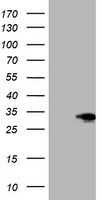 SIX1 Antibody - HEK293T cells were transfected with the pCMV6-ENTRY control (Left lane) or pCMV6-ENTRY SIX1 (Right lane) cDNA for 48 hrs and lysed. Equivalent amounts of cell lysates (5 ug per lane) were separated by SDS-PAGE and immunoblotted with anti-SIX1.