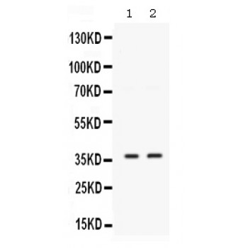 SIX1 Antibody - Western blot analysis of SIX1 expression in MCF-7 whole cell lysates (lane 1) and 22RV1 whole cell lysates (lane 2). SIX1 at 37 kD was detected using rabbit anti- SIX1 Antigen Affinity purified polyclonal antibody at 0.5 ug/mL. The blot was developed using chemiluminescence (ECL) method.