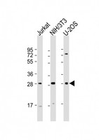 SIX1 Antibody - All lanes: Anti-SIX1 Antibody (Center) at 1:2000 dilution. Lane 1: Jurkat whole cell lysate. Lane 2: NIH/3T3 whole cell lysate. Lane 3: U-2OS whole cell lysate Lysates/proteins at 20 ug per lane. Secondary Goat Anti-Rabbit IgG, (H+L), Peroxidase conjugated at 1:10000 dilution. Predicted band size: 32 kDa. Blocking/Dilution buffer: 5% NFDM/TBST.