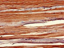 SIX1 Antibody - Immunohistochemistry of paraffin-embedded human skeletal muscle tissue using SIX1 Antibody at dilution of 1:100