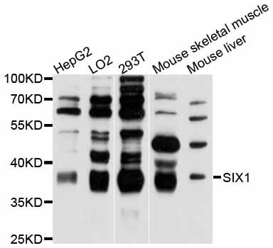 SIX1 Antibody - Western blot analysis of extracts of various cell lines, using SIX1 antibody at 1:3000 dilution. The secondary antibody used was an HRP Goat Anti-Rabbit IgG (H+L) at 1:10000 dilution. Lysates were loaded 25ug per lane and 3% nonfat dry milk in TBST was used for blocking. An ECL Kit was used for detection and the exposure time was 20s.