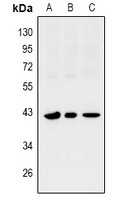 SIX1 Antibody - Western blot analysis of SIX1 expression in PC12 (A), MEF (B), COS7 (C) whole cell lysates.