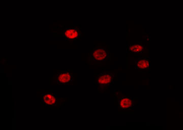 SIX1 Antibody - Staining 293T cells by IF/ICC. The samples were fixed with PFA and permeabilized in 0.1% Triton X-100, then blocked in 10% serum for 45 min at 25°C. The primary antibody was diluted at 1:200 and incubated with the sample for 1 hour at 37°C. An Alexa Fluor 594 conjugated goat anti-rabbit IgG (H+L) Ab, diluted at 1/600, was used as the secondary antibody.