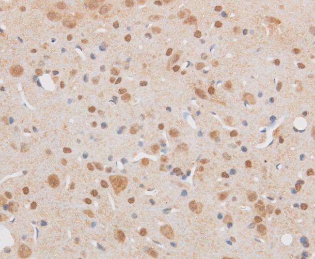 SIX1 Antibody - Immunohistochemistry of paraffin-embedded Mouse brain using SIX1 Polyclonal Antibody at dilution of 1:50.