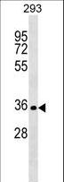 SIX2 Antibody - SIX2 Antibody western blot of 293 cell line lysates (35 ug/lane). The SIX2 antibody detected the SIX2 protein (arrow).