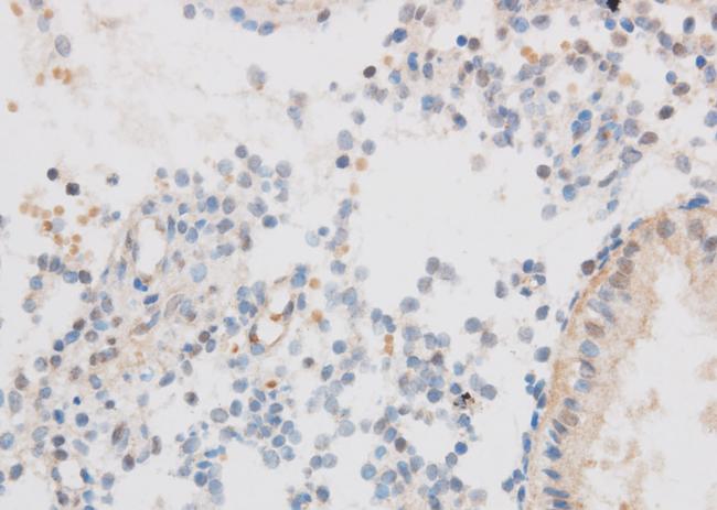 SIX2 Antibody - Immunohistochemistry of paraffin-embedded Mouse lung using SIX2 Polyclonal Antibody at dilution of 1:50.