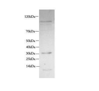 SIX2 Antibody - Western Blot analysis of Rat skeletal muscle using SIX2 Polyclonal Antibody at dilution of 1:600.