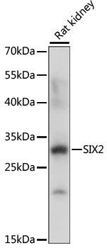 SIX2 Antibody - Western blot analysis of extracts of Rat kidney using SIX2 Polyclonal Antibody at dilution of 1:1000.