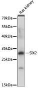SIX2 Antibody - Western blot analysis of extracts of Rat kidney using SIX2 Polyclonal Antibody at dilution of 1:1000.