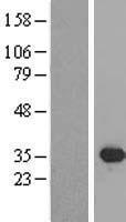 SIX2 Protein - Western validation with an anti-DDK antibody * L: Control HEK293 lysate R: Over-expression lysate