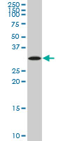 SIX3 Antibody - SIX3 monoclonal antibody (M01), clone 3D12. Western Blot analysis of SIX3 expression in human thyroid(diffuse hyperplasia).