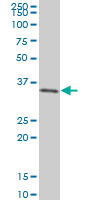 SIX3 Antibody - SIX3 monoclonal antibody (M01), clone 3D12 Western Blot analysis of SIX3 expression in 293.