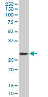 SIX3 Antibody - SIX3 monoclonal antibody (M01), clone 3D12. Western Blot analysis of SIX3 expression in MES-SA/Dx5.