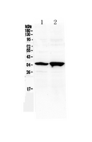 SIX3 Antibody - Western blot analysis of Six3 using anti-Six3 antibody. Electrophoresis was performed on a 5-20% SDS-PAGE gel at 70V (Stacking gel) / 90V (Resolving gel) for 2-3 hours. The sample well of each lane was loaded with 50ug of sample under reducing conditions. Lane 1: rat brain tissue lysate,Lane 2: mouse brain tissue lysate. After Electrophoresis, proteins were transferred to a Nitrocellulose membrane at 150mA for 50-90 minutes. Blocked the membrane with 5% Non-fat Milk/ TBS for 1.5 hour at RT. The membrane was incubated with rabbit anti-Six3 antigen affinity purified polyclonal antibody at 0.5 µg/mL overnight at 4°C, then washed with TBS-0.1% Tween 3 times with 5 minutes each and probed with a goat anti-rabbit IgG-HRP secondary antibody at a dilution of 1:10000 for 1.5 hour at RT. The signal is developed using an Enhanced Chemiluminescent detection (ECL) kit with Tanon 5200 system. A specific band was detected for Six3 at approximately 35KD. The expected band size for Six3 is at 35KD.