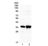 SIX3 Antibody - Western blot testing of 1) rat brain and 2) mouse brain with Six3 antibody at 0.5ug/ml. Predicted molecular weight ~35 kDa.