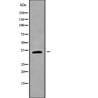 SIX3 Antibody - Western blot analysis SIX3 using A549 whole cells lysates