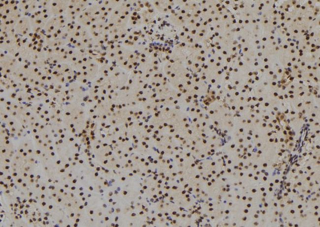 SIX3 Antibody - 1:100 staining mouse kidney tissue by IHC-P. The sample was formaldehyde fixed and a heat mediated antigen retrieval step in citrate buffer was performed. The sample was then blocked and incubated with the antibody for 1.5 hours at 22°C. An HRP conjugated goat anti-rabbit antibody was used as the secondary.