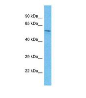 SIX4 Antibody - Western blot of Human Pancreas Tumor. SIX4 antibody dilution 1.0 ug/ml.  This image was taken for the unconjugated form of this product. Other forms have not been tested.