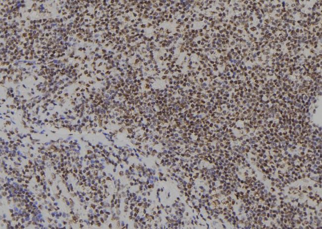SIX4 Antibody - 1:100 staining human spleen tissue by IHC-P. The sample was formaldehyde fixed and a heat mediated antigen retrieval step in citrate buffer was performed. The sample was then blocked and incubated with the antibody for 1.5 hours at 22°C. An HRP conjugated goat anti-rabbit antibody was used as the secondary.