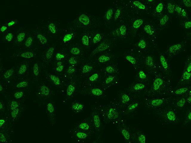 SIX4 Antibody - Immunofluorescence staining of SIX4 in U2OS cells. Cells were fixed with 4% PFA, permeabilzed with 0.1% Triton X-100 in PBS, blocked with 10% serum, and incubated with rabbit anti-Human SIX4 polyclonal antibody (dilution ratio 1:200) at 4°C overnight. Then cells were stained with the Alexa Fluor 488-conjugated Goat Anti-rabbit IgG secondary antibody (green). Positive staining was localized to Nucleus.