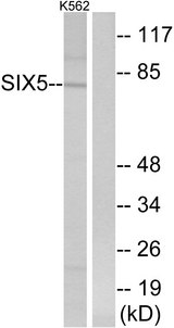 SIX5 Antibody - Western blot analysis of lysates from K562 cells, using SIX5 Antibody. The lane on the right is blocked with the synthesized peptide.