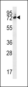 SIX5 Antibody - SIX5 Antibody western blot of MDA-MB231 cell line lysates (35 ug/lane). The SIX5 antibody detected the SIX5 protein (arrow).