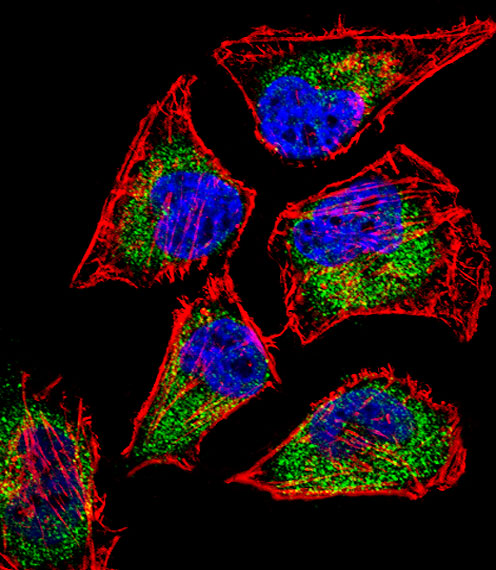 SIX5 Antibody - Fluorescent confocal image of HeLa cell stained with SIX5 Antibody. HeLa cells were fixed with 4% PFA (20 min), permeabilized with Triton X-100 (0.1%, 10 min), then incubated with SIX5 primary antibody (1:25, 1 h at 37°C). For secondary antibody, Alexa Fluor 488 conjugated donkey anti-rabbit antibody (green) was used (1:400, 50 min at 37°C). Cytoplasmic actin was counterstained with Alexa Fluor 555 (red) conjugated Phalloidin (7units/ml, 1 h at 37°C). Nuclei were counterstained with DAPI (blue) (10 ug/ml, 10 min). SIX5 immunoreactivity is localized to Cytoplasm significantly.