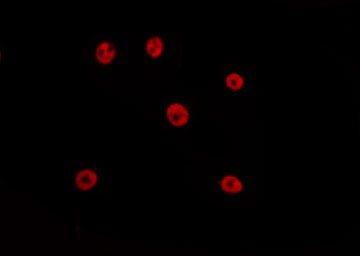 SIX5 Antibody - Staining HepG2 cells by IF/ICC. The samples were fixed with PFA and permeabilized in 0.1% Triton X-100, then blocked in 10% serum for 45 min at 25°C. The primary antibody was diluted at 1:200 and incubated with the sample for 1 hour at 37°C. An Alexa Fluor 594 conjugated goat anti-rabbit IgG (H+L) Ab, diluted at 1/600, was used as the secondary antibody.
