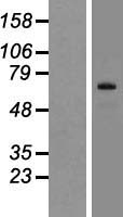SIX5 Protein - Western validation with an anti-DDK antibody * L: Control HEK293 lysate R: Over-expression lysate