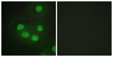 SIX6 Antibody - Immunofluorescence analysis of HepG2 cells, using SIX6 Antibody. The picture on the right is blocked with the synthesized peptide.