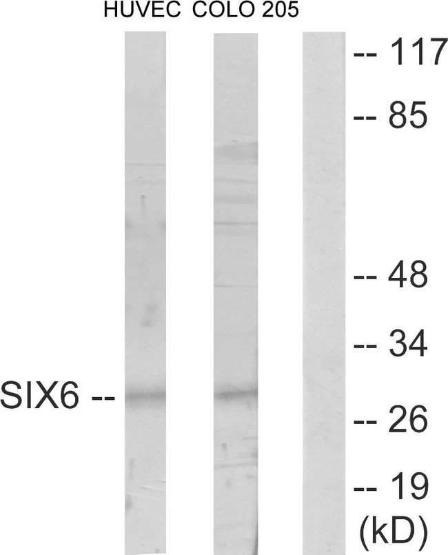 SIX6 Antibody - Western blot analysis of lysates from HUVEC and COLO205 cells, using SIX6 Antibody. The lane on the right is blocked with the synthesized peptide.