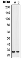 SIX6 Antibody - Western blot analysis of SIX6 expression in Jurkat (A); NIH3T3 (B) whole cell lysates.