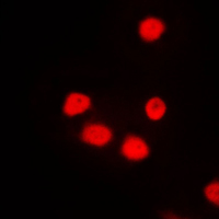 SIX6 Antibody - Immunofluorescent analysis of SIX6 staining in NIH3T3 cells. Formalin-fixed cells were permeabilized with 0.1% Triton X-100 in TBS for 5-10 minutes and blocked with 3% BSA-PBS for 30 minutes at room temperature. Cells were probed with the primary antibody in 3% BSA-PBS and incubated overnight at 4 C in a humidified chamber. Cells were washed with PBST and incubated with a DyLight 594-conjugated secondary antibody (red) in PBS at room temperature in the dark. DAPI was used to stain the cell nuclei (blue).
