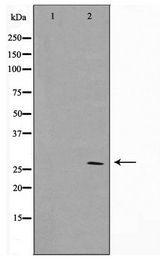 SIX6 Antibody - Western blot of HUVEC cell lysate using SIX6 Antibody