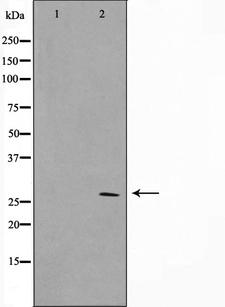 SIX6 Antibody - Western blot analysis on HuvEc cell lysates using SIX6 antibody. The lane on the left is treated with the antigen-specific peptide.