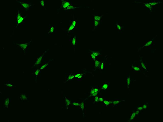 SIX6 Antibody - Immunofluorescence staining of SIX6 in SHSY5Y cells. Cells were fixed with 4% PFA, permeabilzed with 0.1% Triton X-100 in PBS, blocked with 10% serum, and incubated with rabbit anti-Human SIX6 polyclonal antibody (dilution ratio 1:200) at 4°C overnight. Then cells were stained with the Alexa Fluor 488-conjugated Goat Anti-rabbit IgG secondary antibody (green). Positive staining was localized to Nucleus.
