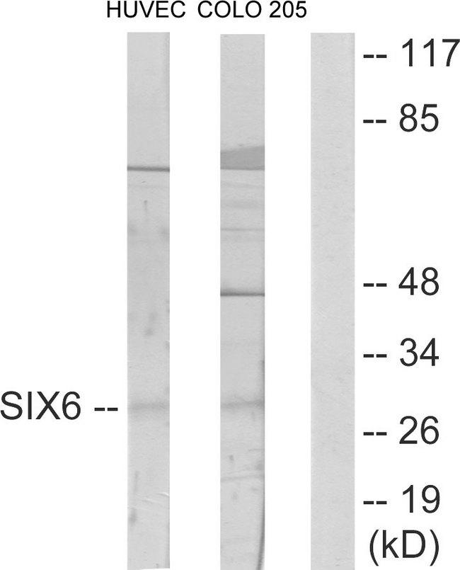 SIX6 Antibody - Western blot analysis of extracts from HUVEC cells and COLO205 cells, using SIX6 antibody.
