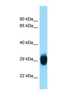 SKA1 Antibody - SKA1 antibody Western blot of Mouse Pancreas lysate. Antibody concentration 1 ug/ml.  This image was taken for the unconjugated form of this product. Other forms have not been tested.