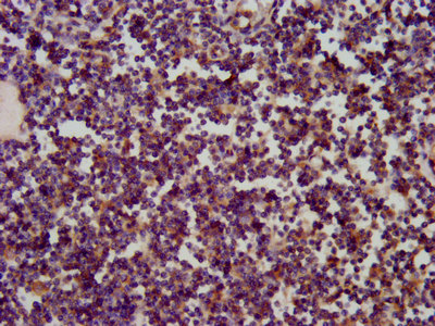 SKA1 Antibody - Immunohistochemistry image at a dilution of 1:200 and staining in paraffin-embedded human lymph node tissue performed on a Leica BondTM system. After dewaxing and hydration, antigen retrieval was mediated by high pressure in a citrate buffer (pH 6.0) . Section was blocked with 10% normal goat serum 30min at RT. Then primary antibody (1% BSA) was incubated at 4 °C overnight. The primary is detected by a biotinylated secondary antibody and visualized using an HRP conjugated SP system.