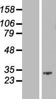 SKA1 Protein - Western validation with an anti-DDK antibody * L: Control HEK293 lysate R: Over-expression lysate